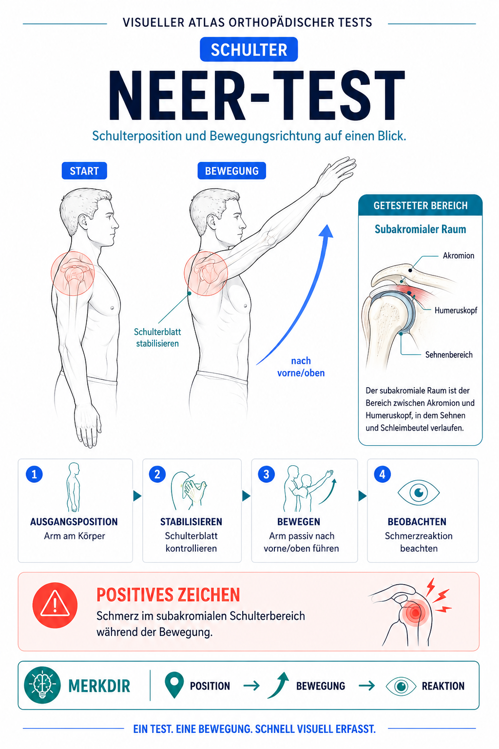 NEER-TEST – Schulter
